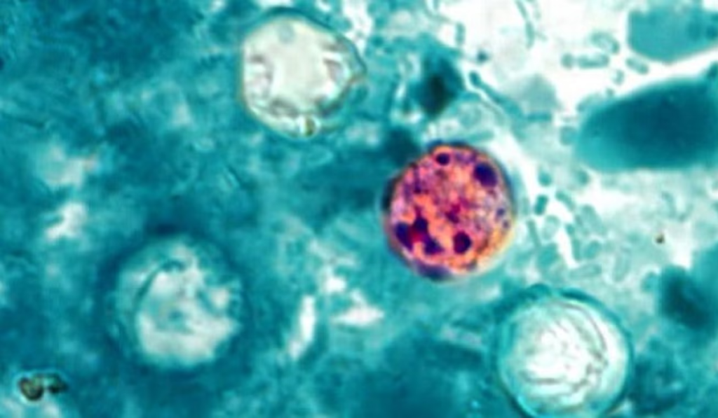 Cyclospora Parasite Outbreak
