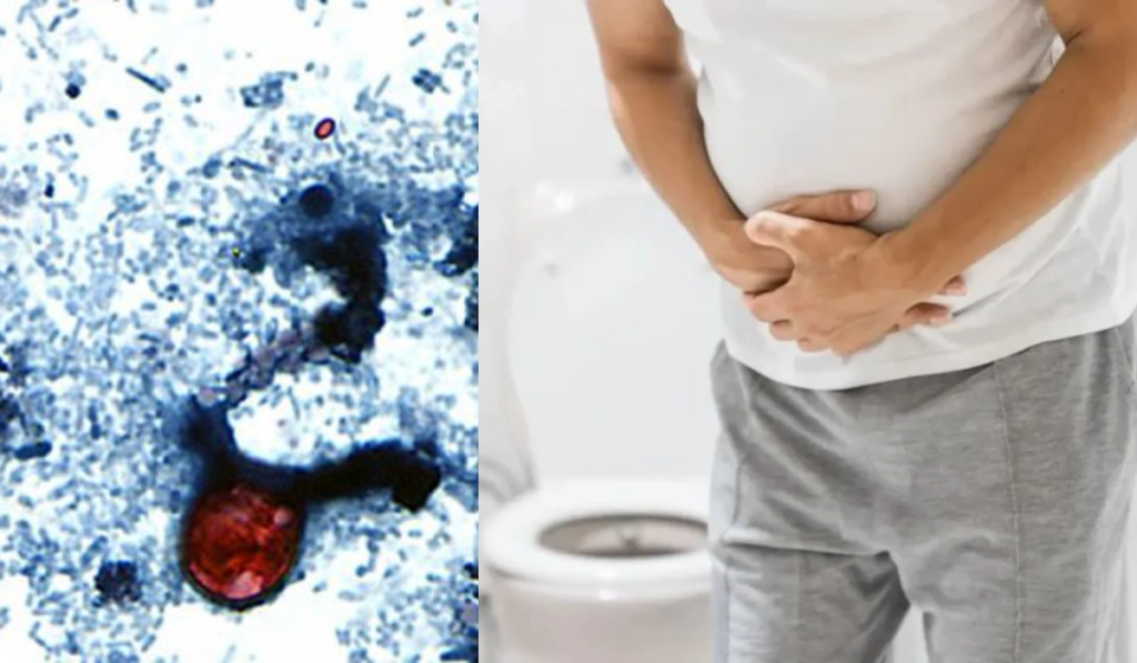 Explosive Diarrhea Outbreak
