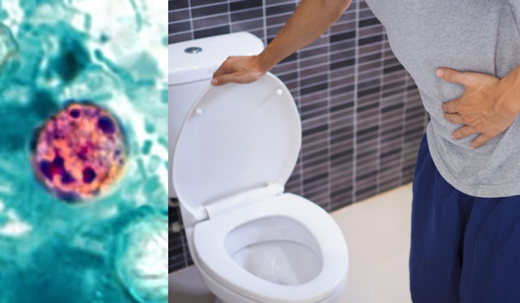 Explosive Diarrhea Outbreak