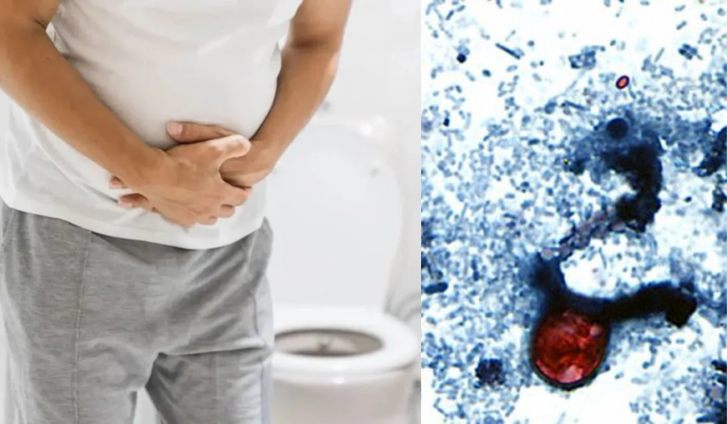 Explosive Diarrhea Outbreak