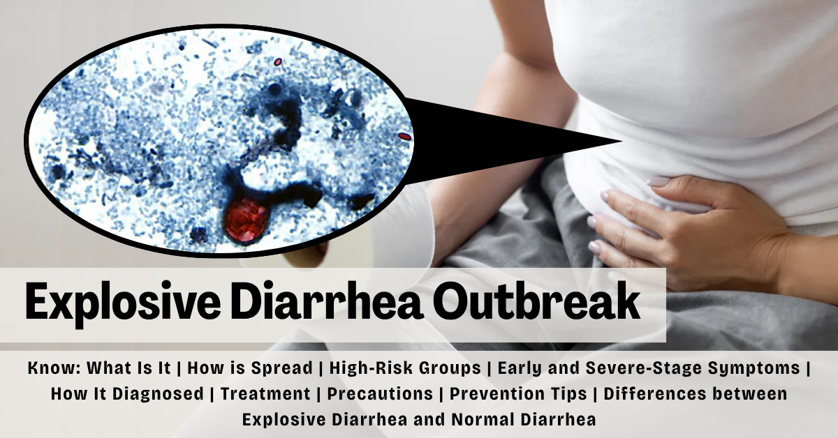 Explosive Diarrhea Outbreak